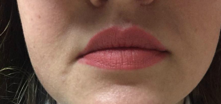 Lip correction