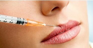 Lip augmentation