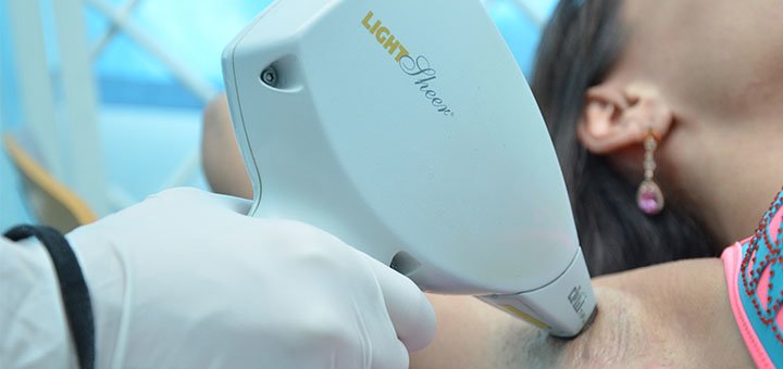 Underarm laser hair removal at the MEDLINE aesthetic cosmetology center in Kharkov. Sign up for laser hair removal at a discount.