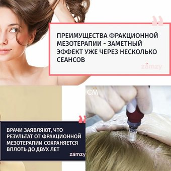 Мезотерапія шкіри голови - коли допомагає вона і тільки вона
