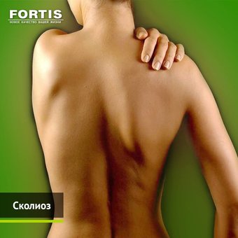 Лікування і профілактика сколіозу - лікарі «Fortis» рекомендують