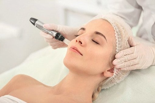 Мікронідлінг в салоні «Lazerepil»