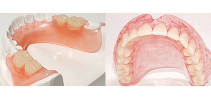 Denture prosthesis strife